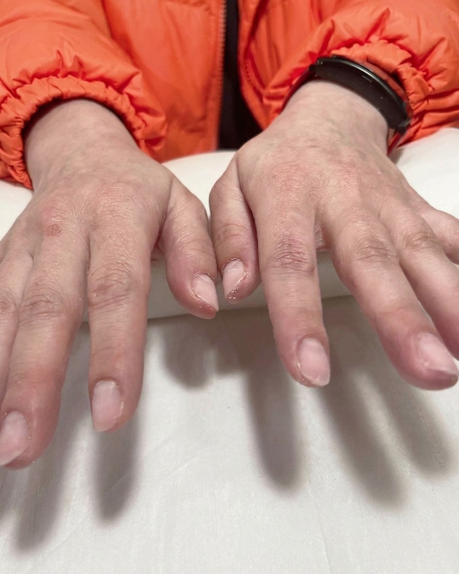 Gros plan sur une main utilisant une pince pour retirer délicatement un pochoir violet dun ongle, révélant une pointe ombrée blanche nette.