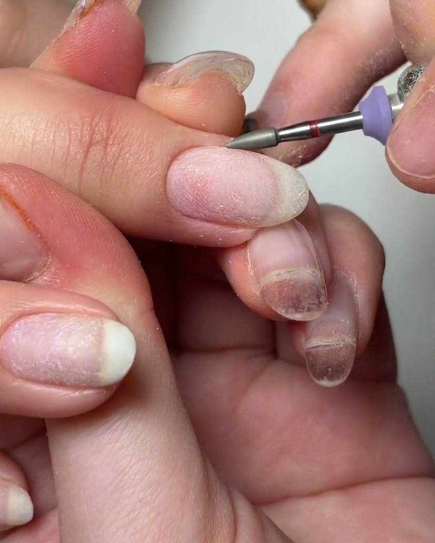Un embout conique utilisé pour nettoyer le contour de la cuticule avec de lalcool.