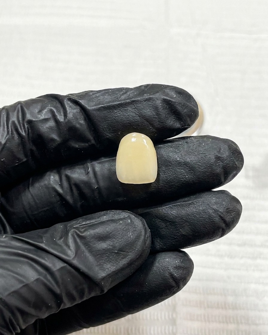 Gros plan dun ongle avec le motif sombre en cours de catalysation sous une petite lampe UV.