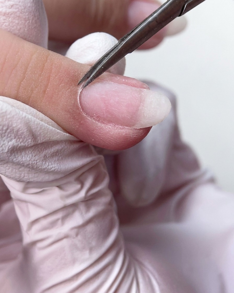 De petits ciseaux à manucure coupant nettement lexcédent de tissu cuticulaire mort à la base de longle.